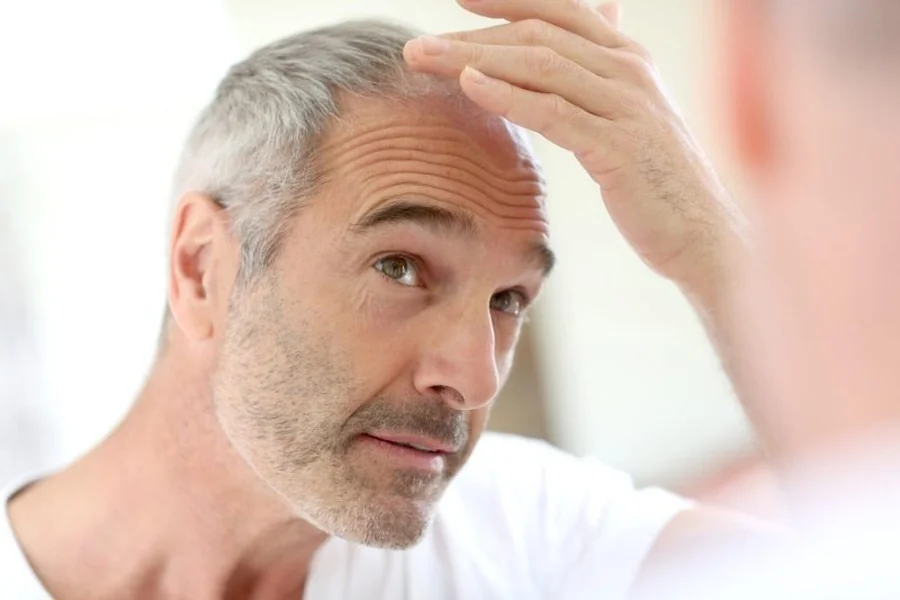 Non-Surgical Hair Solution